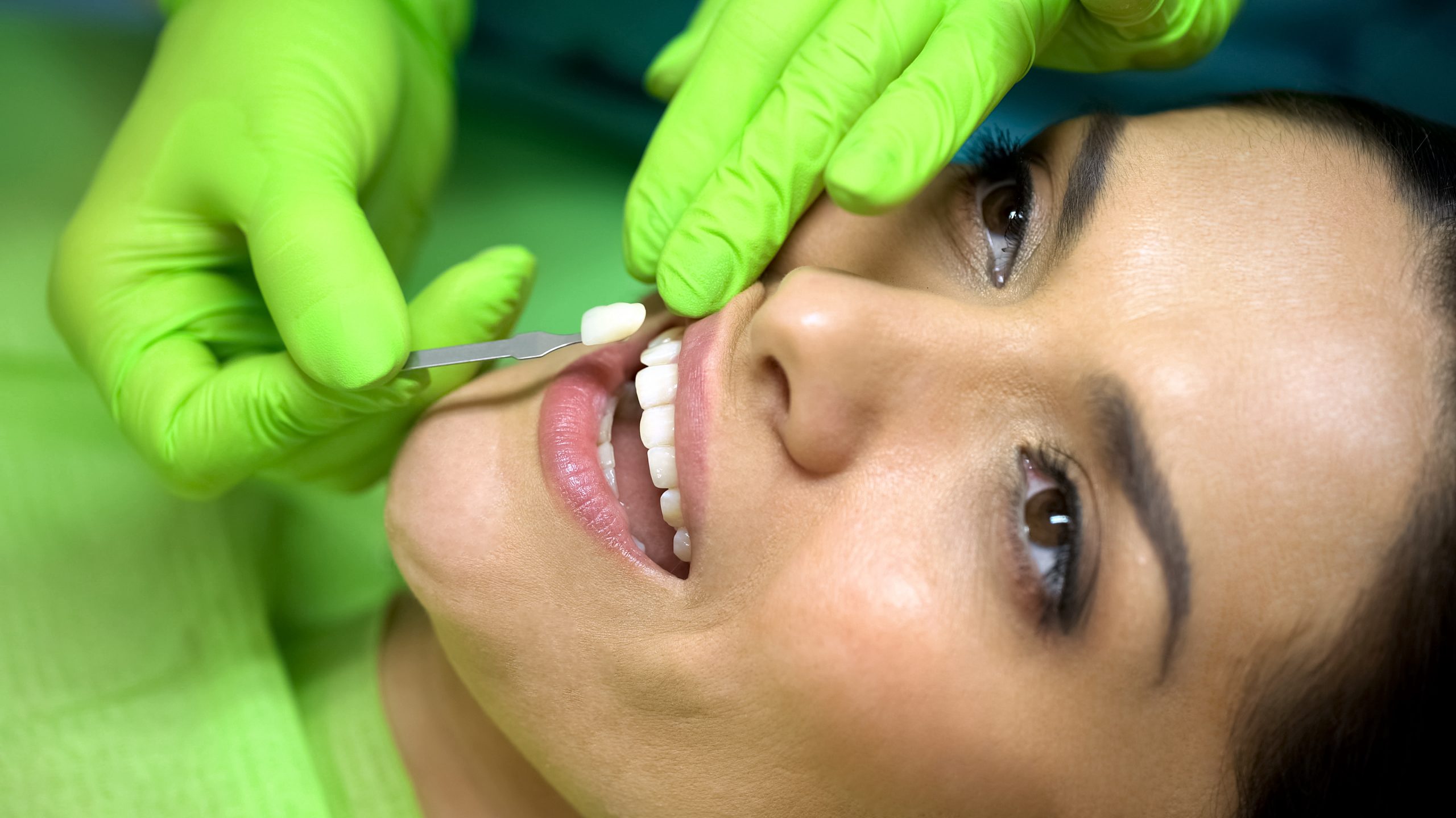 Busting Common Myths About Porcelain Veneers