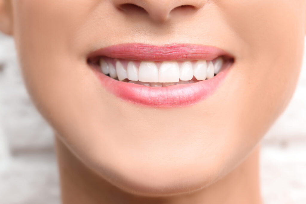 The role of dental bonding in closing tooth gaps