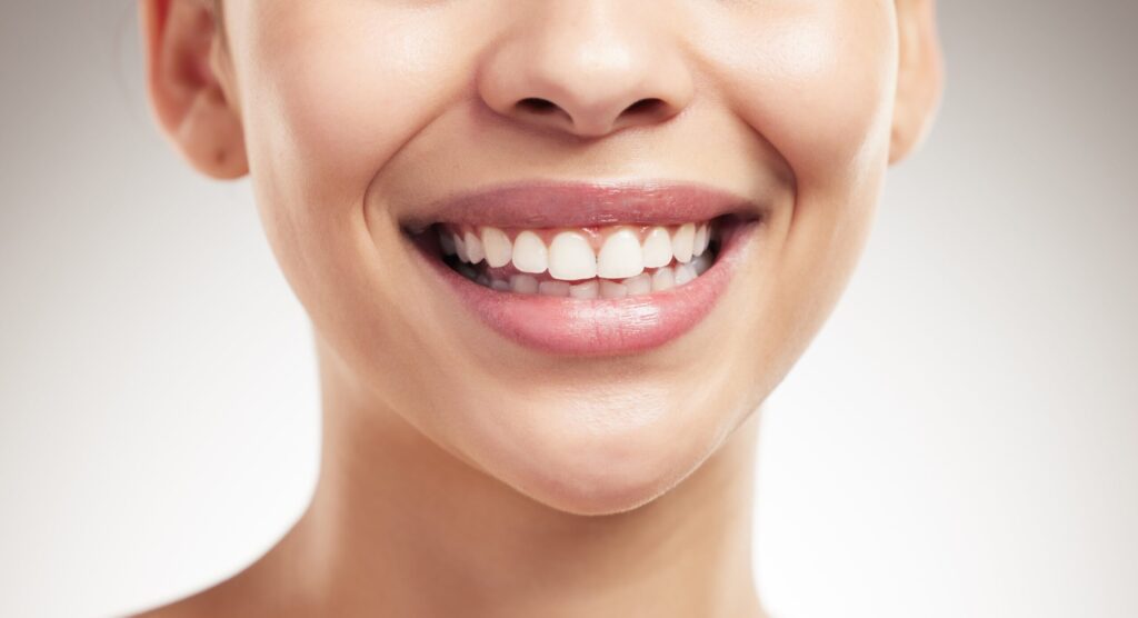 Top Benefits of Professional Teeth Whitening Services