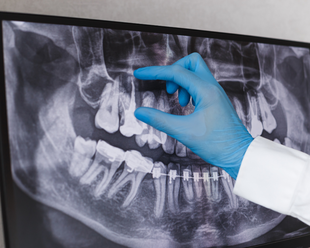 2D and 3D Dental X-Rays