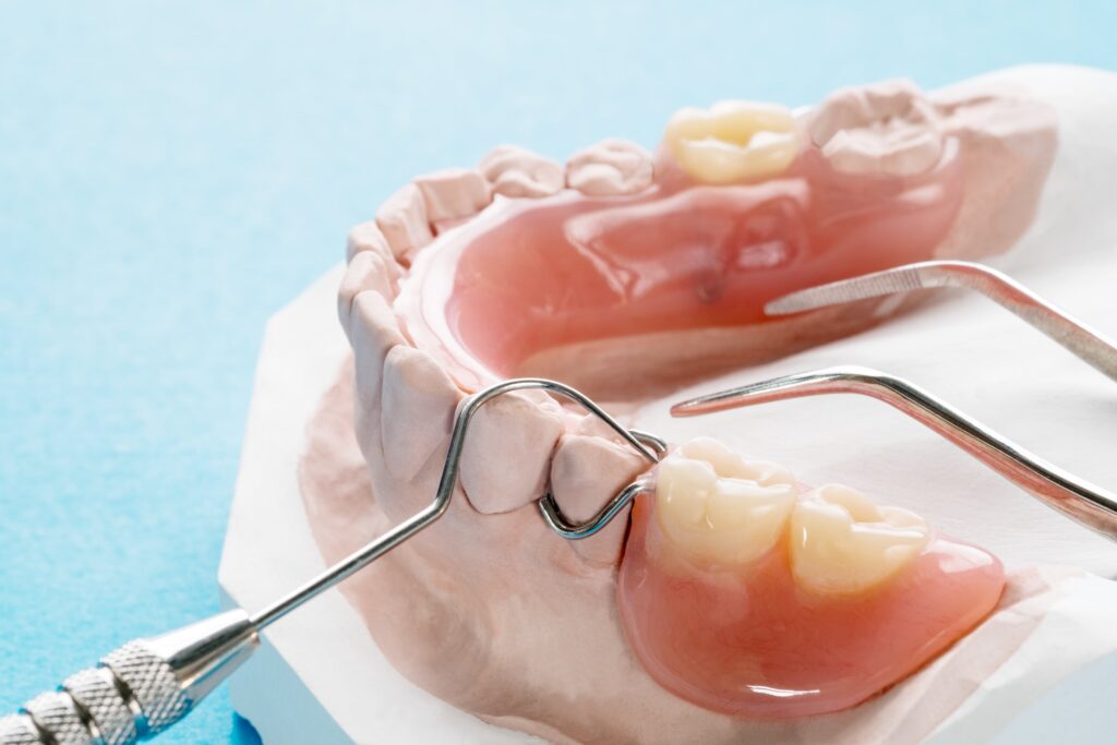 Who Is a Good Candidate for Partial Dentures?
