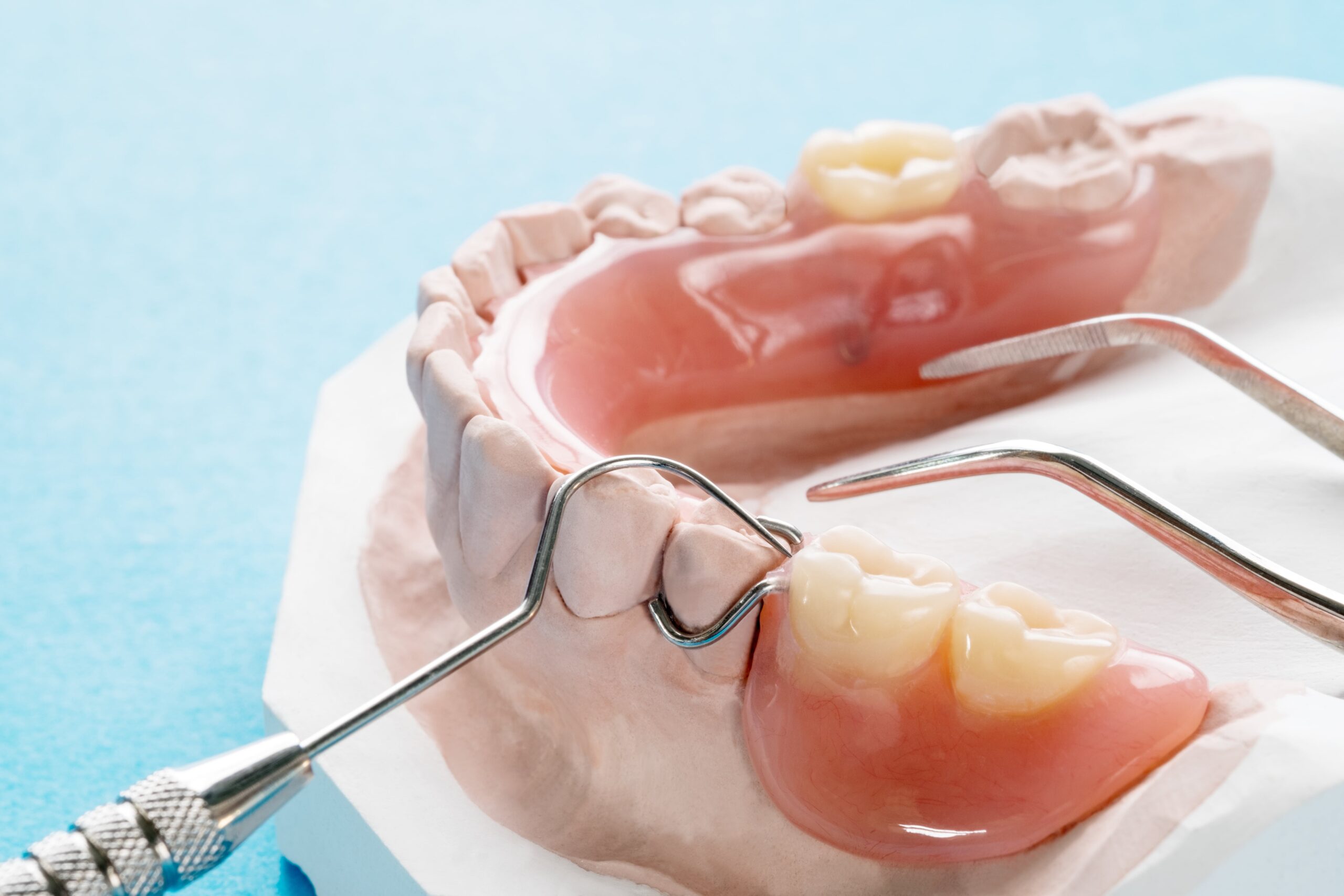 Who Is a Good Candidate for Partial Dentures?