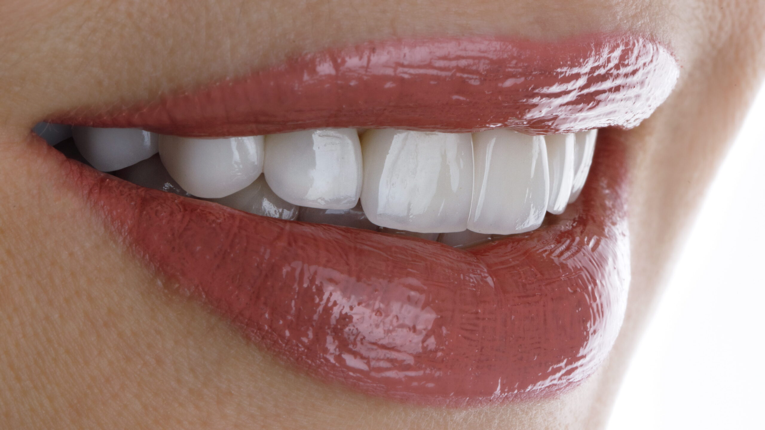 Porcelain Veneers: The Detailed Process for a Beautiful Transformation